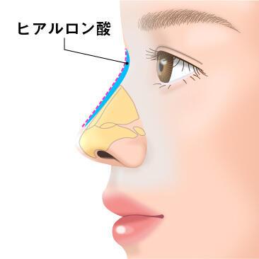 column_nose05_contents27.jpg
