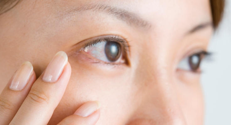 3Dリポアイリフト