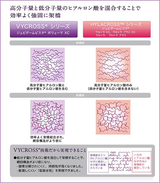 VYCROSS技術について