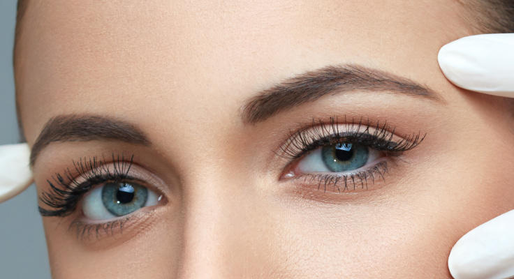 上まぶたのたるみ取り