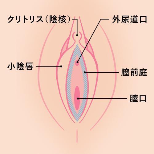 痛みに過敏な部位を除去する「膣前庭部疼痛粘膜切除術」