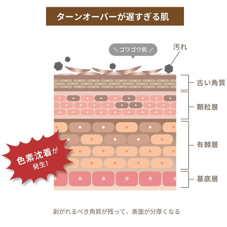 ターンオーバーが遅すぎる場合