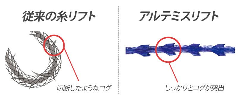 フェイスラインを引き上げたいなら糸リフトがおすすめ