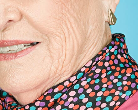 口周りに発生する縦ジワ