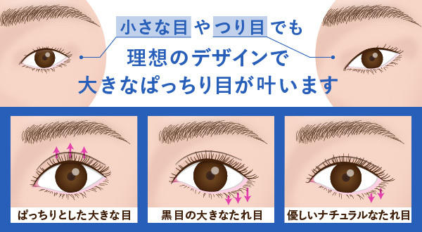 目頭切開で大きく印象的な目元に 小さな目 離れ目 を大きく魅力的な目元に 公式 オザキクリニック