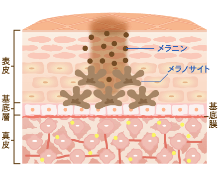 シミとホクロの違いについて